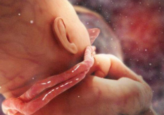 臍帶繞頸怎么辦 嬰兒臍帶繞頸嚴(yán)重嗎