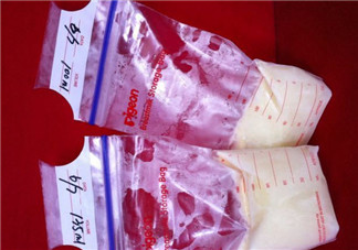 母乳儲存袋哪個牌子好 貝親母乳保存袋怎么樣