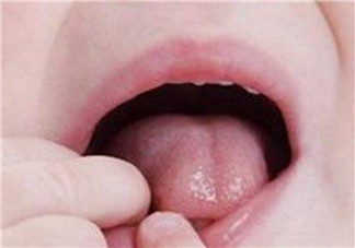 寶寶口腔潰瘍?cè)蛴心男?寶寶口腔潰瘍?cè)趺崔k吃什么好的快