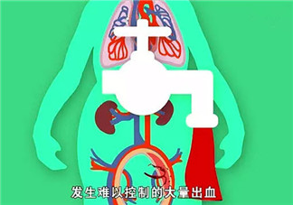 哪些人更容易產(chǎn)后出血 產(chǎn)后出血發(fā)病癥狀(如何預(yù)防產(chǎn)后大出血)