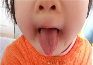 寶寶積食發(fā)燒和感冒發(fā)燒的區(qū)別癥狀 寶寶積食發(fā)燒怎么解決