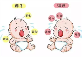 寶寶痱子和濕疹的區(qū)別 濕疹和痱子的區(qū)別圖片
